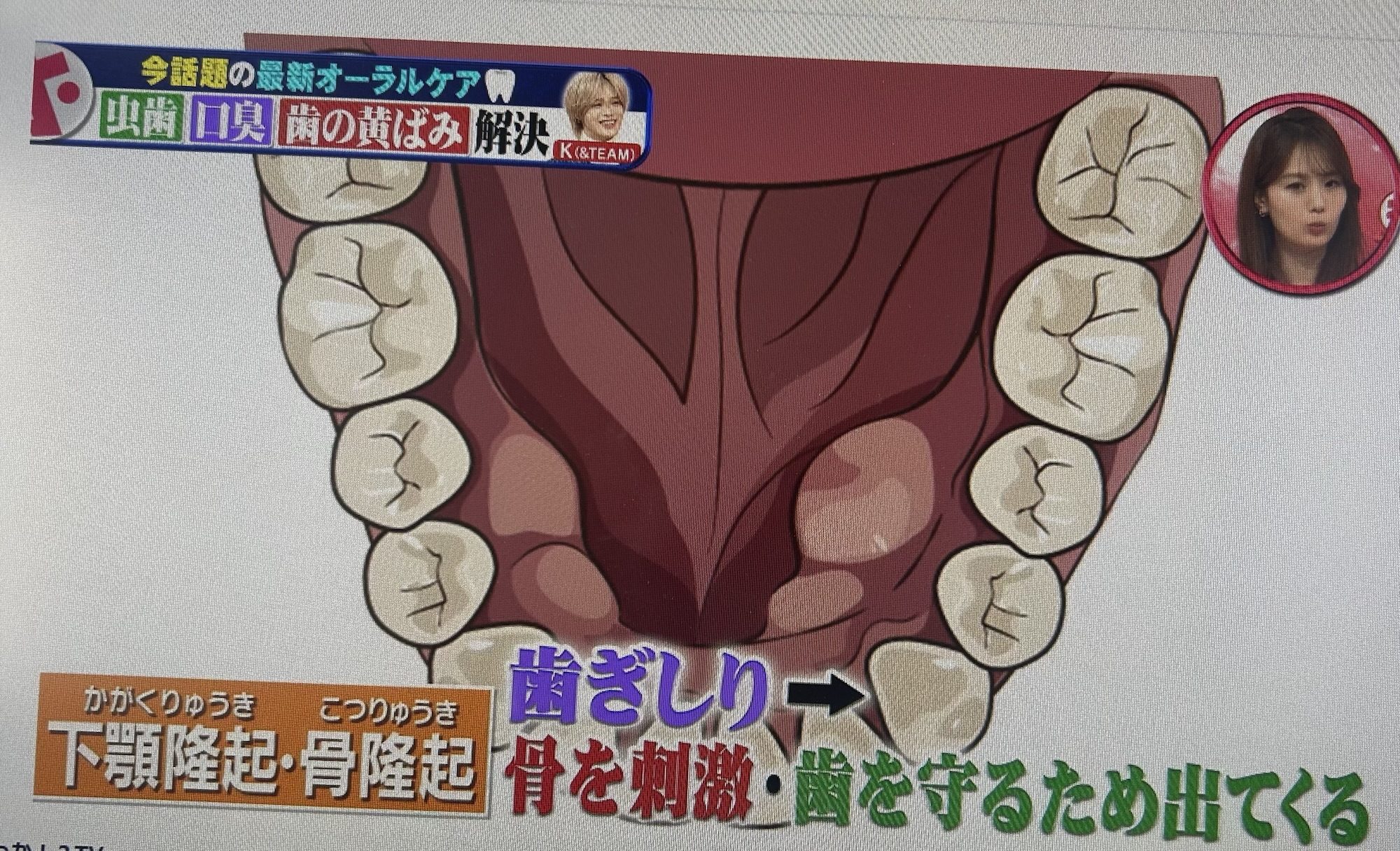 食いしばり、歯ぎしり…
